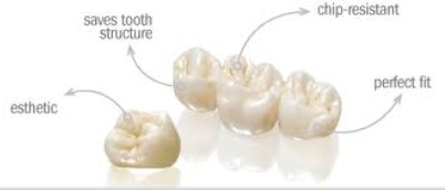 Zirconia Benefits